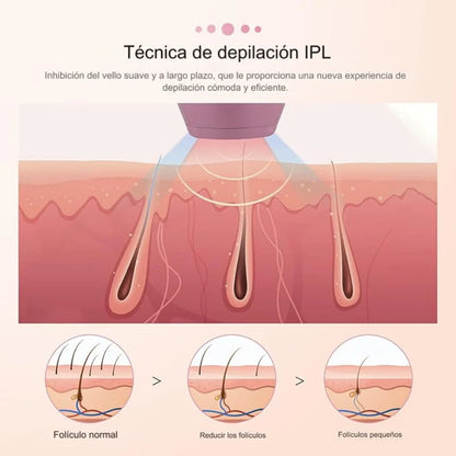 Depiladora Láser en casa IPL
